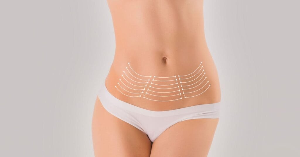 lipo surgery medica hg weby geek | medconnectlatam.com